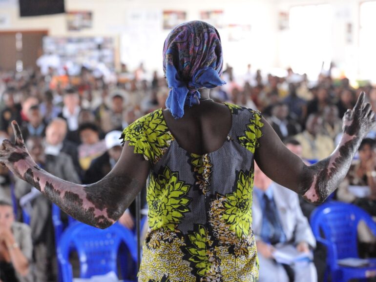 Sobreviviente de la Operación Gukurahundi, una violación genocida autorizada por el Estado: «Los hombres hacían con mi cuerpo lo que querían»