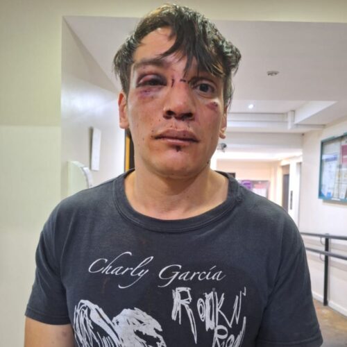 Human Rights Lawyer Matías Darabos, a member of ACVI (Association Against Institutional Violence) and AMMAR (Association of Argentinean Women Merchant Workers), was arrested and beaten during a demonstration during the federal educational march, on April 23, in San Martín square (Retiro, CABA)