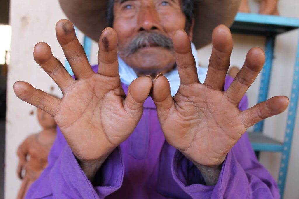 José García Antonio and his "hands that see"