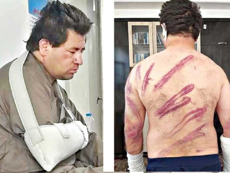 Women’s rights activist tells of beating at hands of Taliban