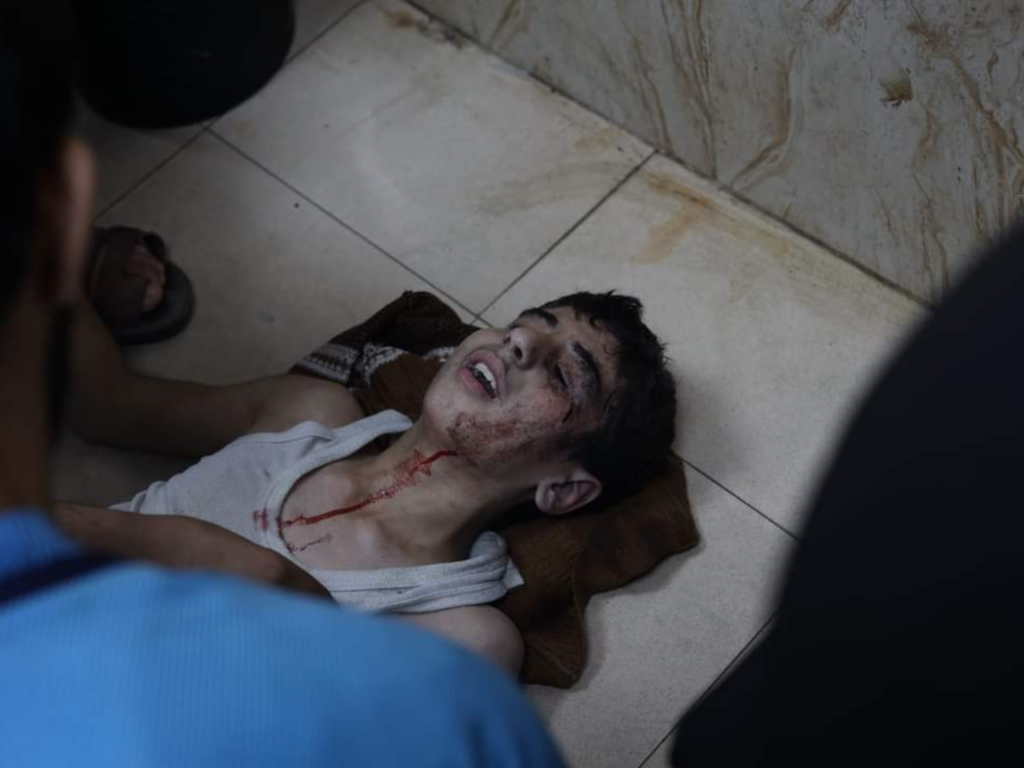 Un sobreviviente sufre sus heridas en Gaza. | Foto cortesía de Fadel Maghari