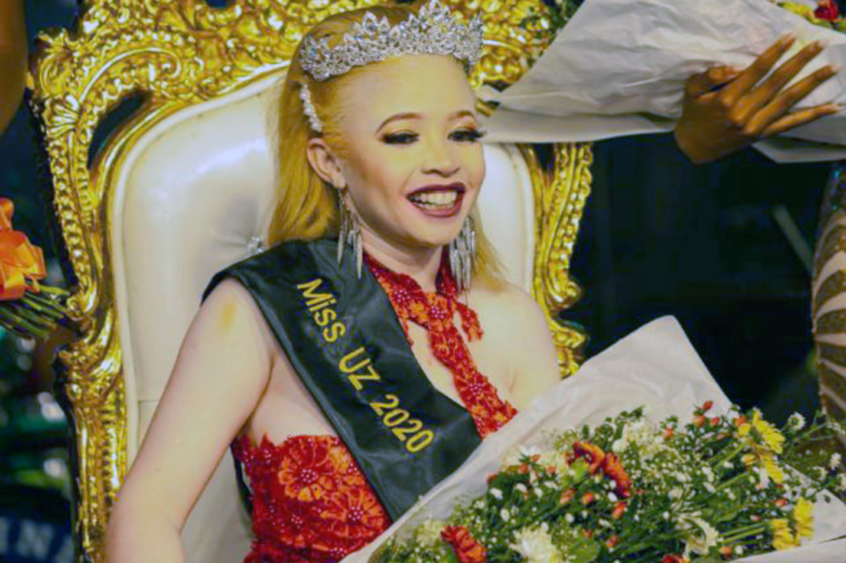 Miss Albinism Zimbabwe usa una tiara y sostiene un ramo