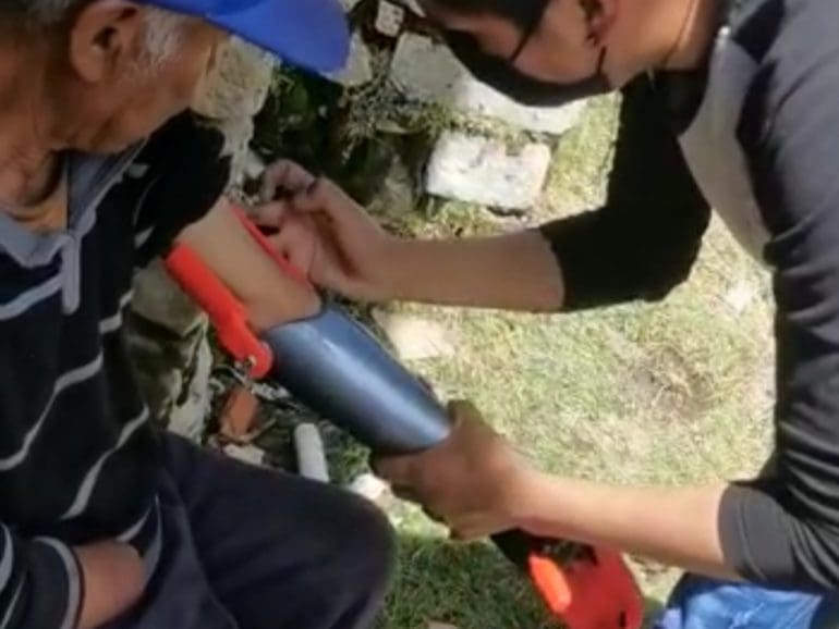 Engineer in Bolivia makes prosthetics for the poor, inspires youth in STEM