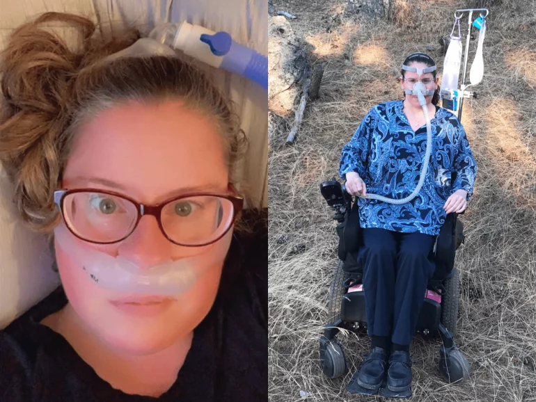 U.S. woman faces incurable disease, launches Anthropology 4U